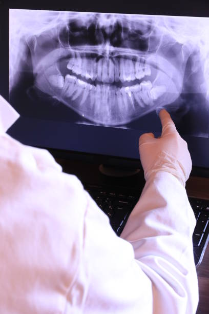 Best Emergency Root Canal Treatment in Wheaton, IL